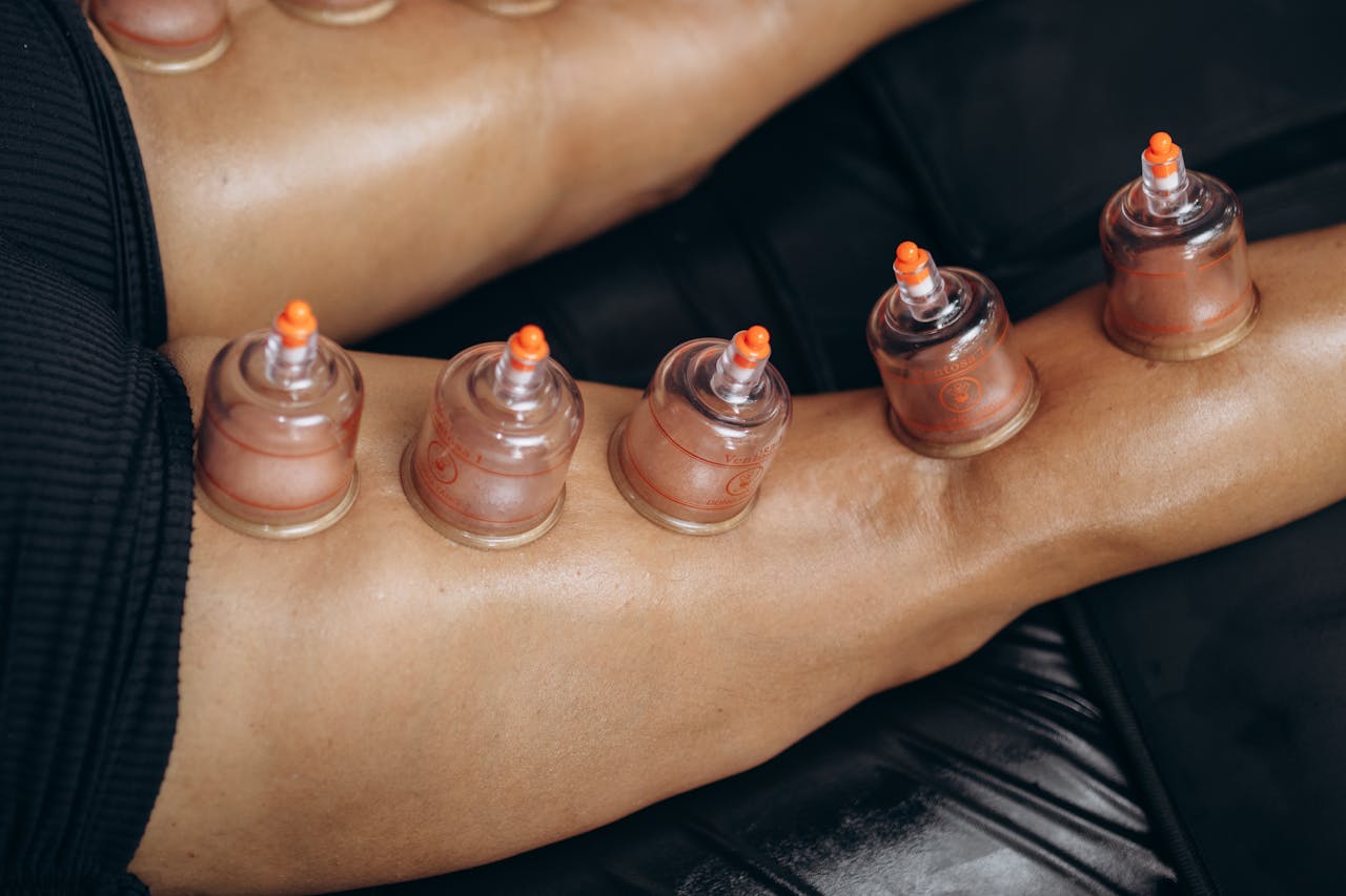 Gliding silicone cups to gently lift tissue and mobilize fascia during a medi-cupping session.
